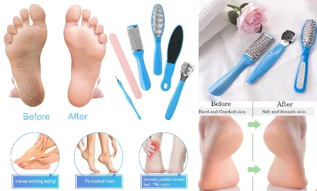 Pedicure Kit for Feet - 10 Piece Set